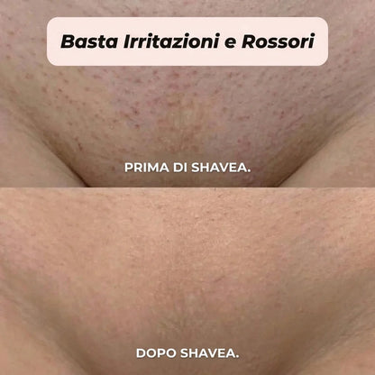 Rasoio 2 in 1 per bikini e corpo Shavea™
